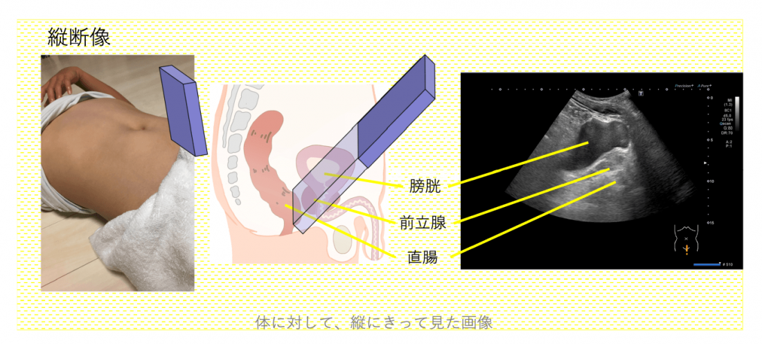 縦断像