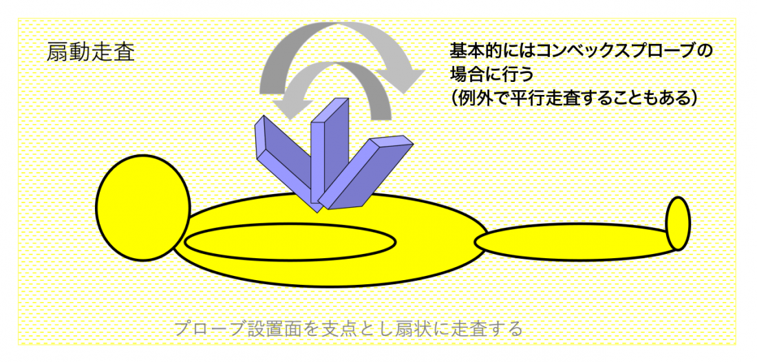 平行走査と扇動走査