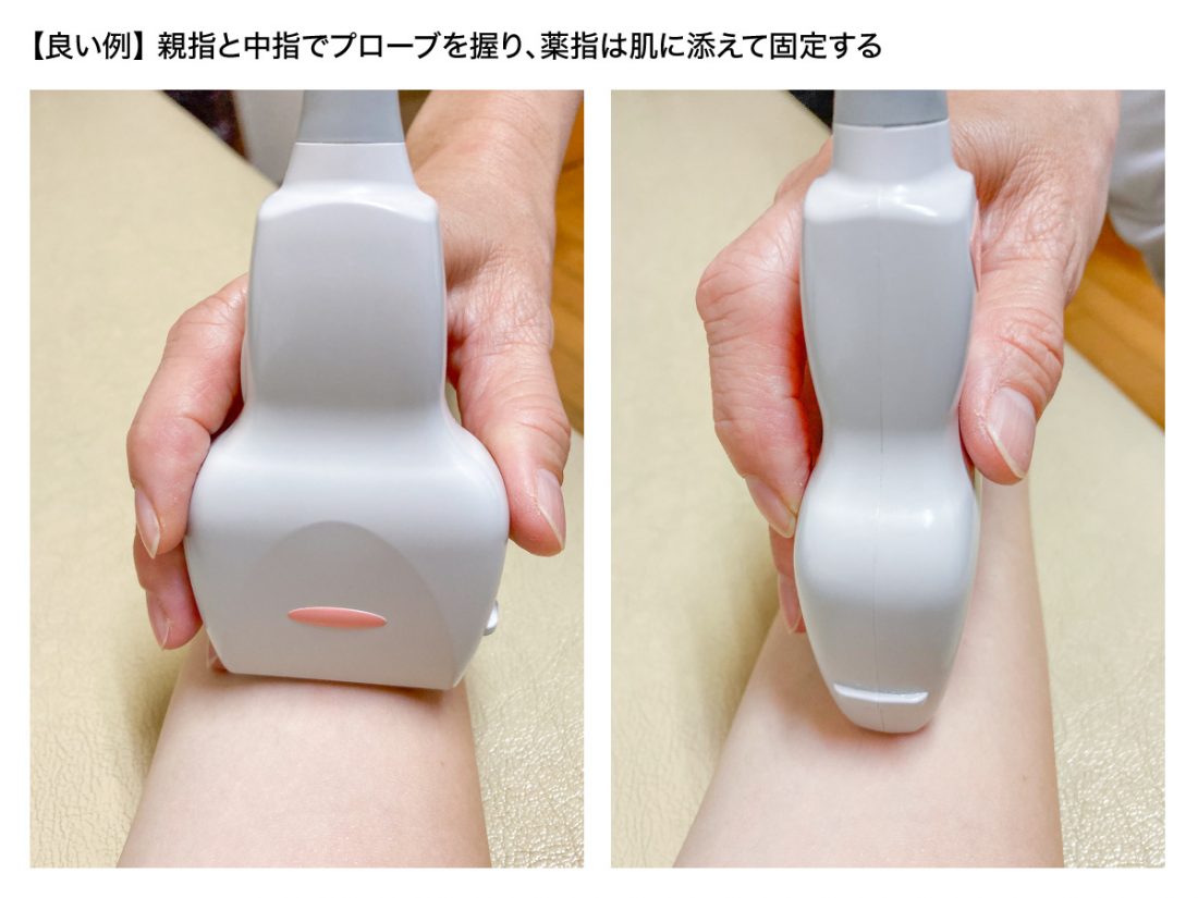 プローブの持ち方 良い例