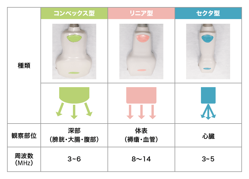 プローブの種類と使い分け