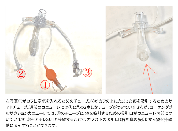 コーケンダブルサクションカニューレ