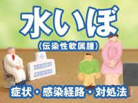 水いぼ（伝染性軟属腫）の症状・感染経路・対処法
