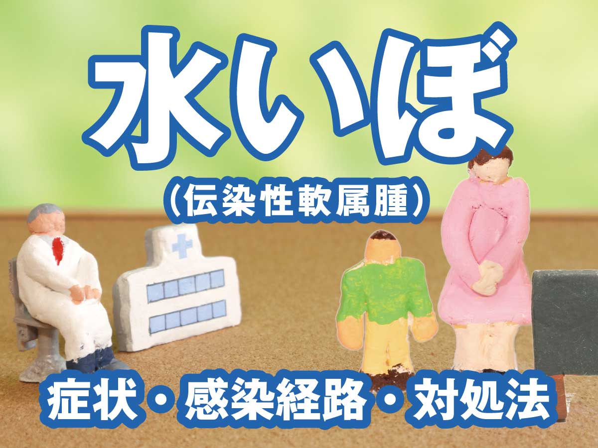 水いぼ（伝染性軟属腫）の症状・感染経路・対処法