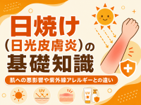 日焼け（日光皮膚炎）の基礎知識