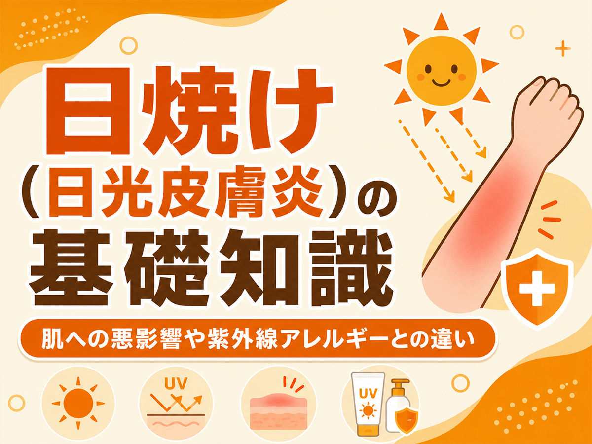 日焼け（日光皮膚炎）の基礎知識
