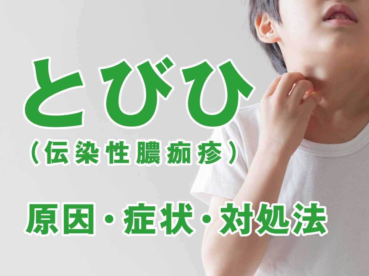 とびひ（伝染性膿痂疹）とは？子どもと大人の症状の違いや原因、治し方