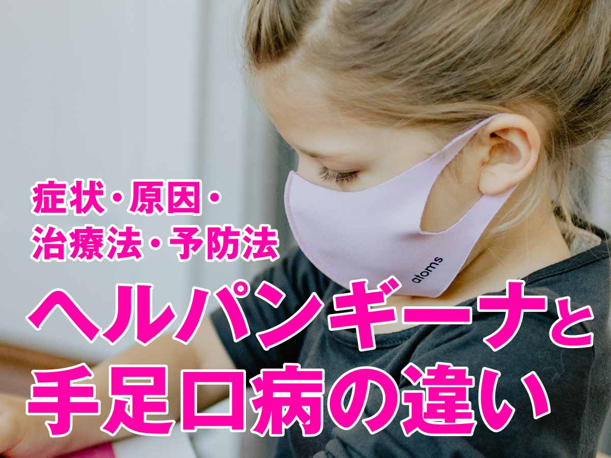 ヘルパンギーナと手足口病の違いは？ 症状・原因・治療法・予防法を解説