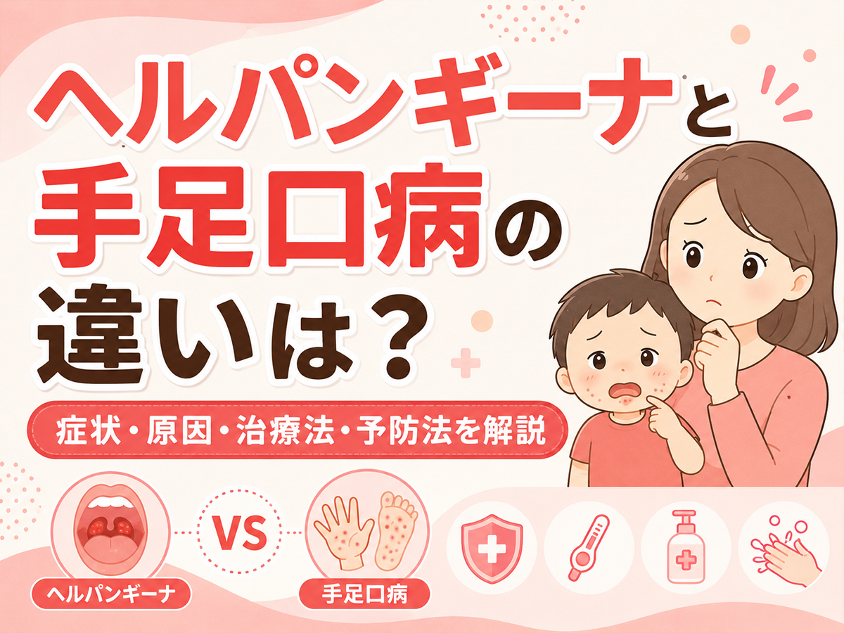ヘルパンギーナと手足口病の違いは？ 症状・原因・治療法・予防法を解説