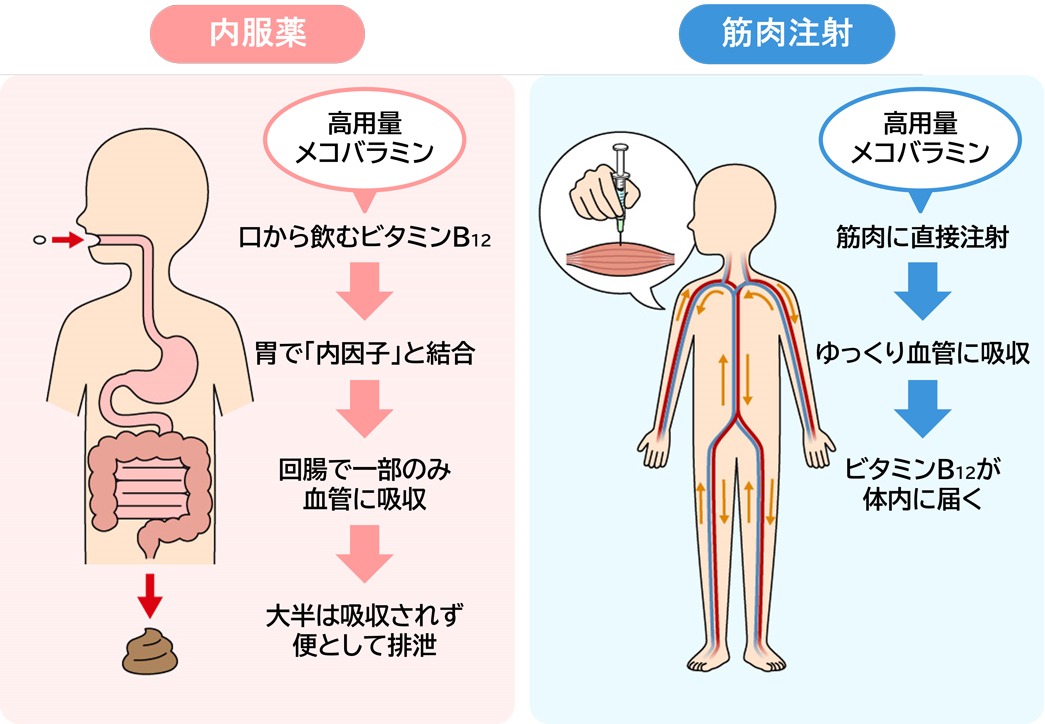 高用量メコバラミンの内服・筋肉注射 比較