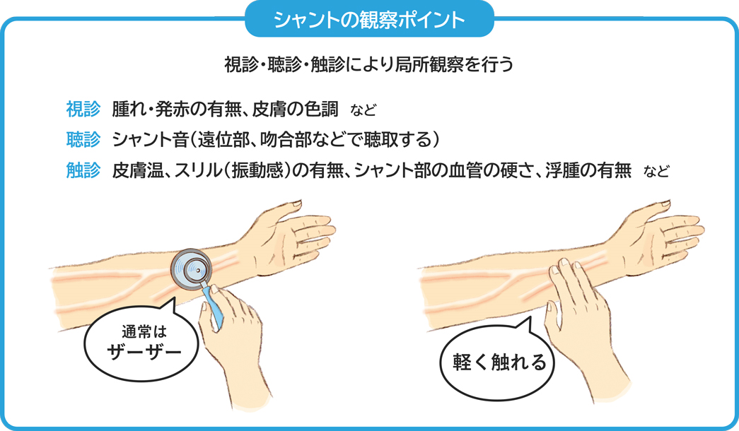 【初期対応】シャント側の上肢を観察