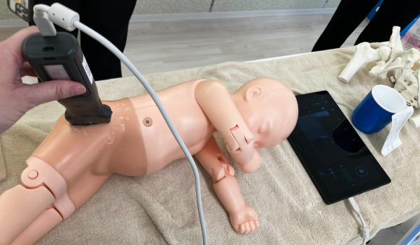 新生児超音波検査の体験
