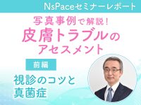 皮膚トラブルのアセスメント　視診のコツと真菌症【セミナーレポート前編】