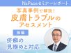 皮膚トラブルのアセスメント　疥癬の見極めと対応【セミナーレポート後編】