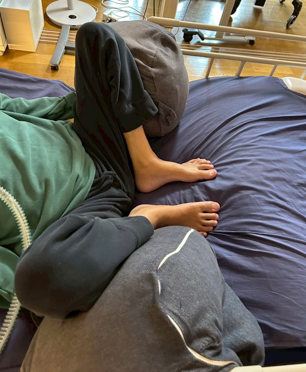 回外肢位を保持する工夫