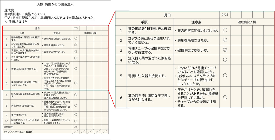 内服注入のチェックリスト