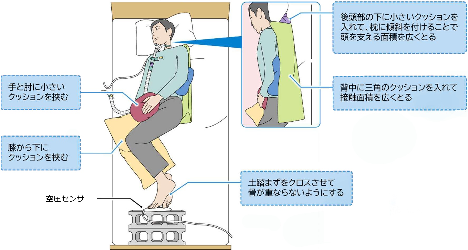 側臥位での姿勢の工夫