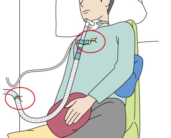 ホースの固定方法
