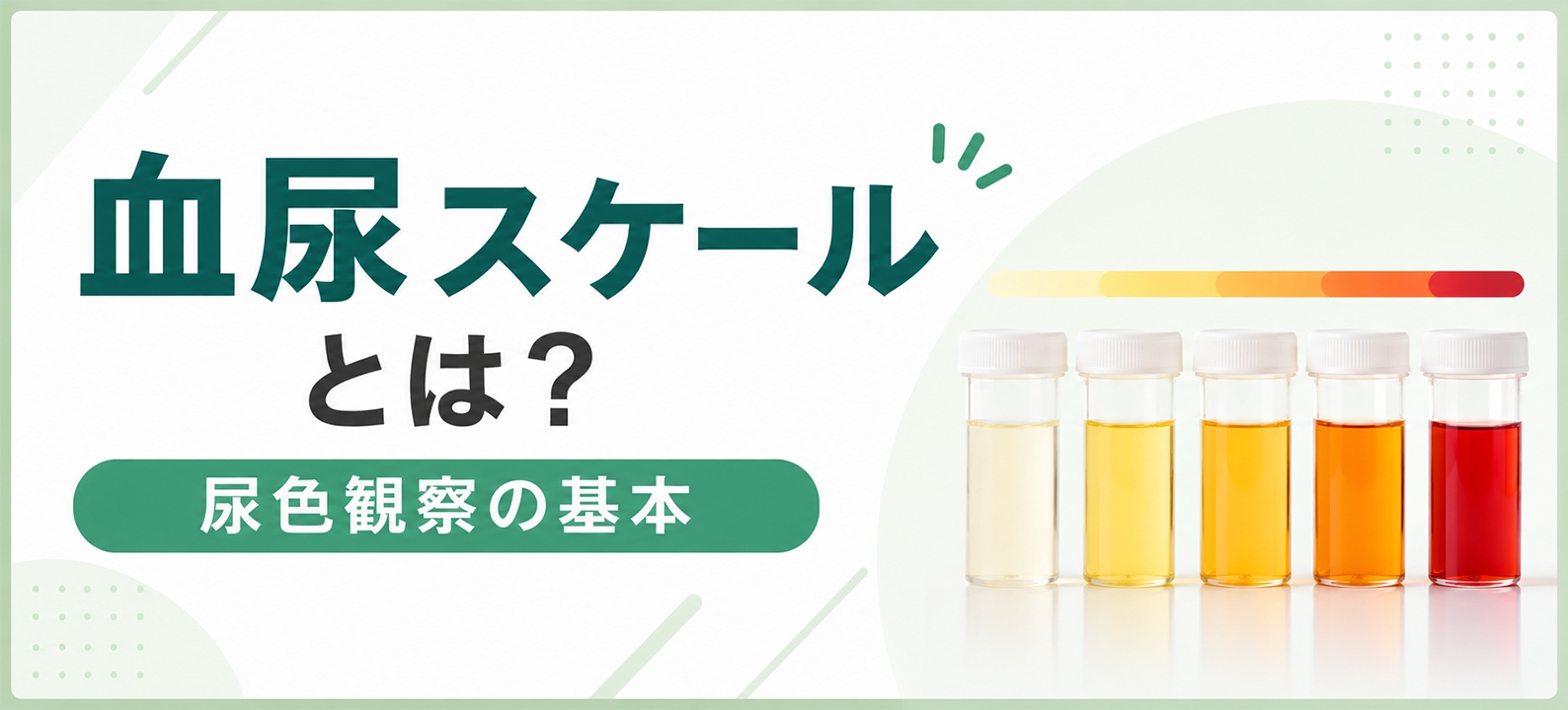 血尿スケールとは?尿色観察の基本