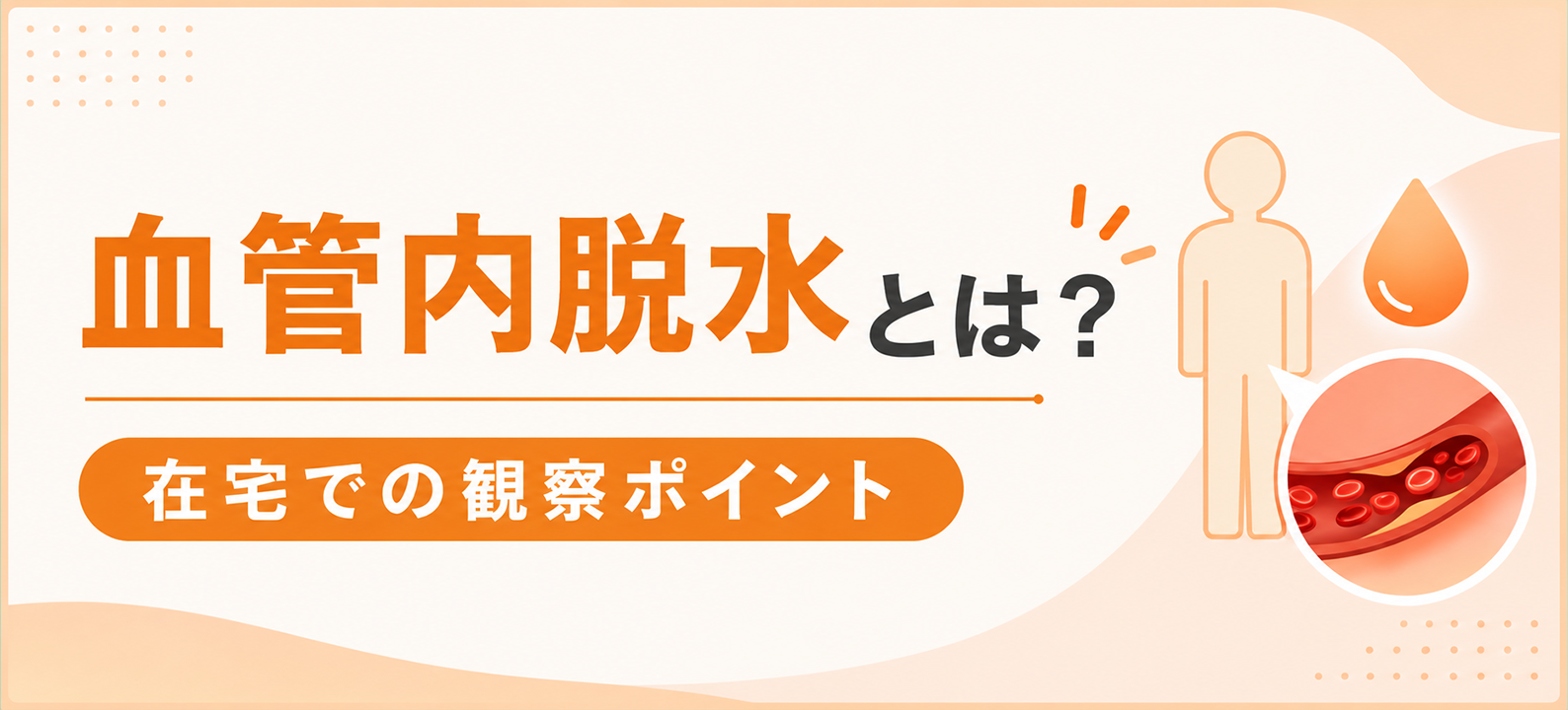 血管内脱水とは?在宅での観察ポイント