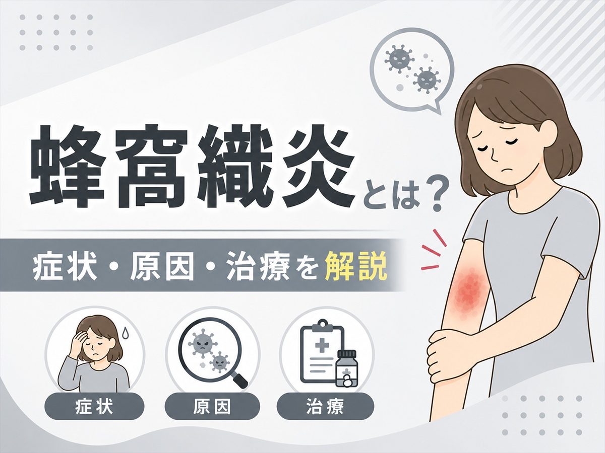 【9月29日up】蜂窩織炎とは？訪問看護で押さえたい症状・観察ポイントと対応